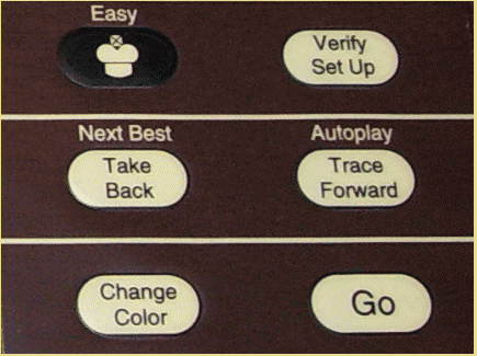 Excalibur Karpov 2294 (2000) Push Button Controls